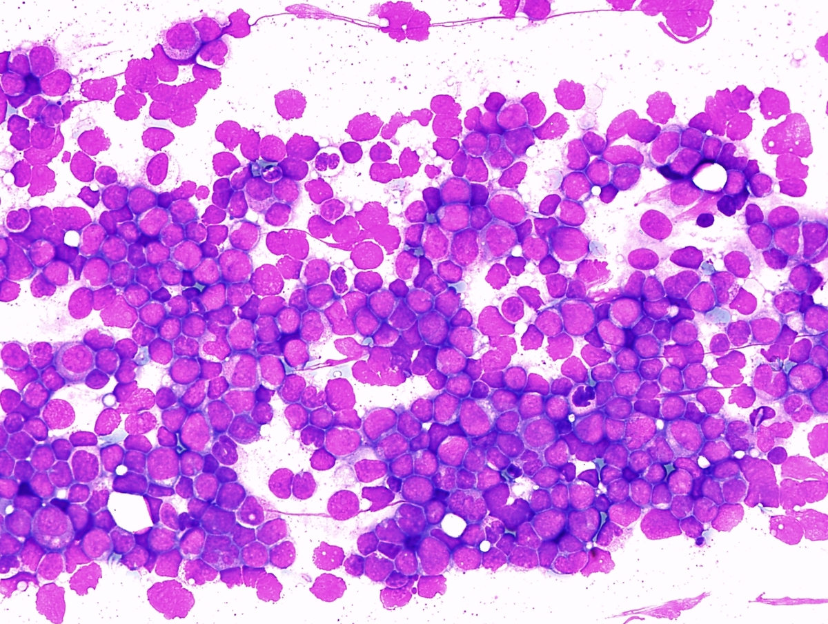 Intraoperative cytology, middle power